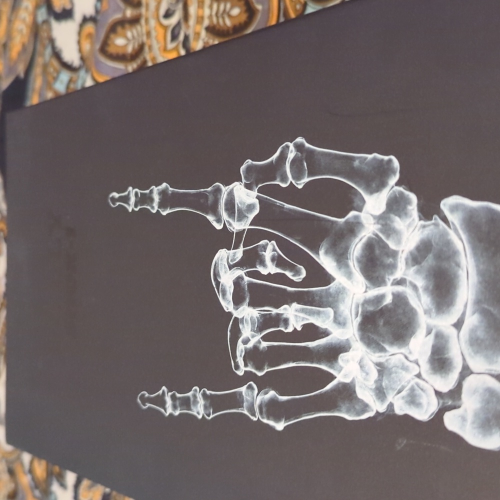 Bally - Picture 7 of 7